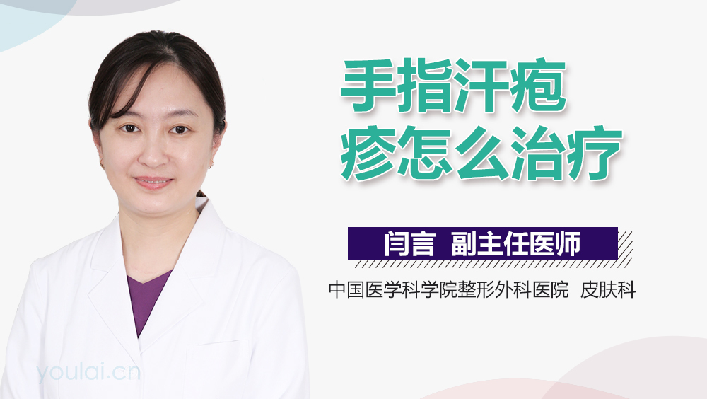 手指汗疱疹怎么治疗
