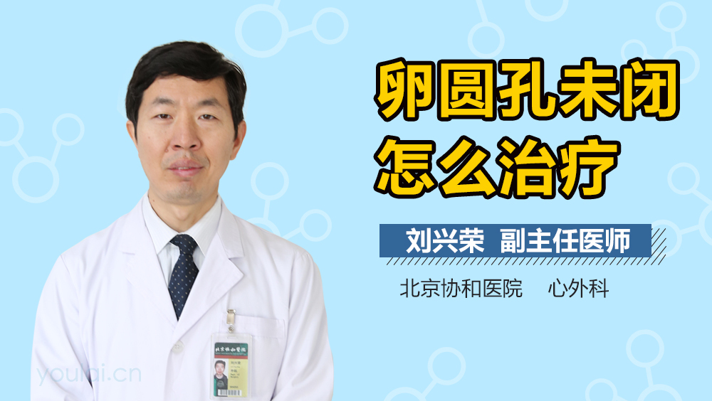 卵圆孔未闭怎么治疗