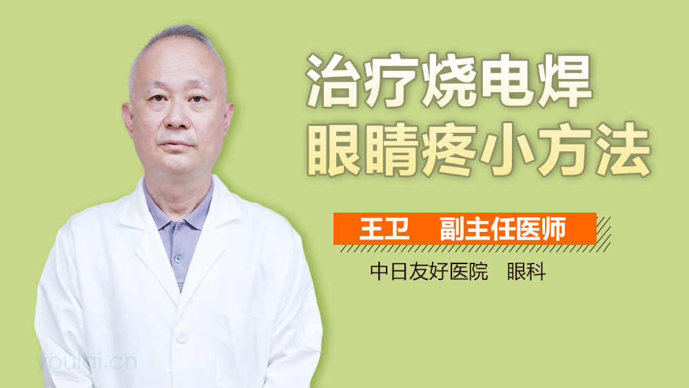 治疗烧电焊眼睛疼小方法