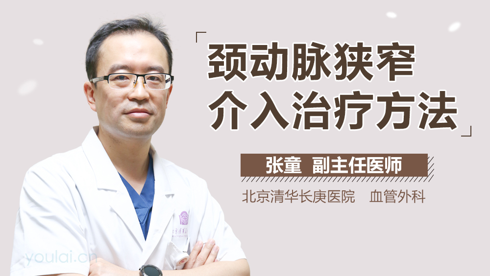 颈动脉狭窄介入治疗方法