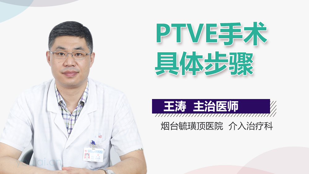PTVE手术具体步骤