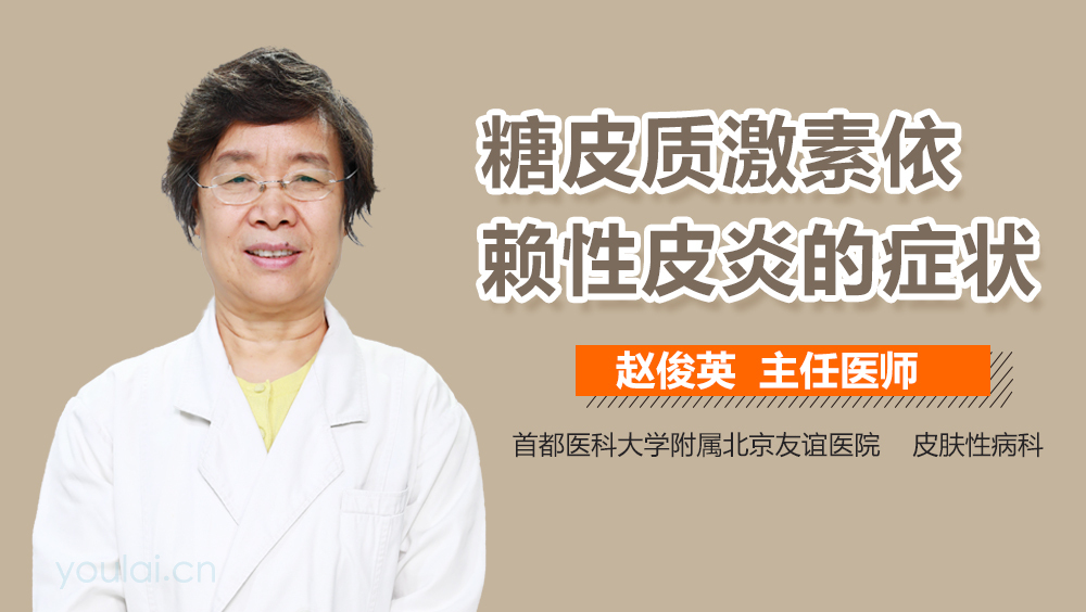 糖皮质激素依赖性皮炎的症状