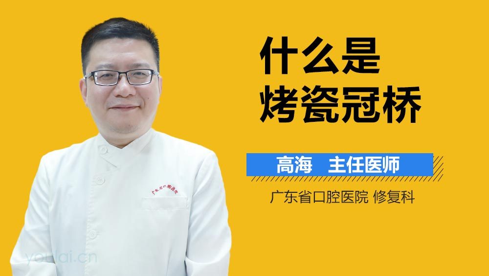 什么是烤瓷冠桥