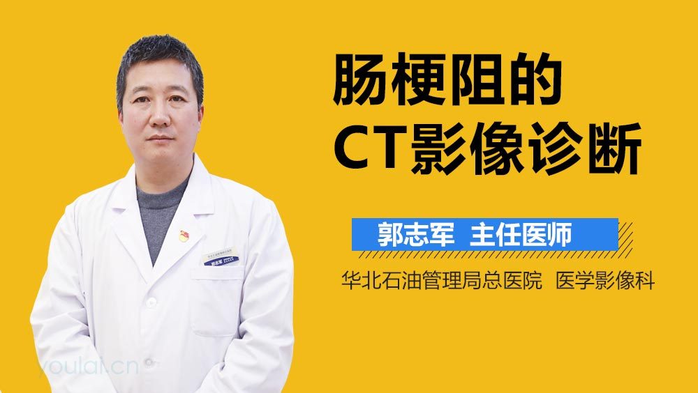 肠梗阻的CT影像诊断