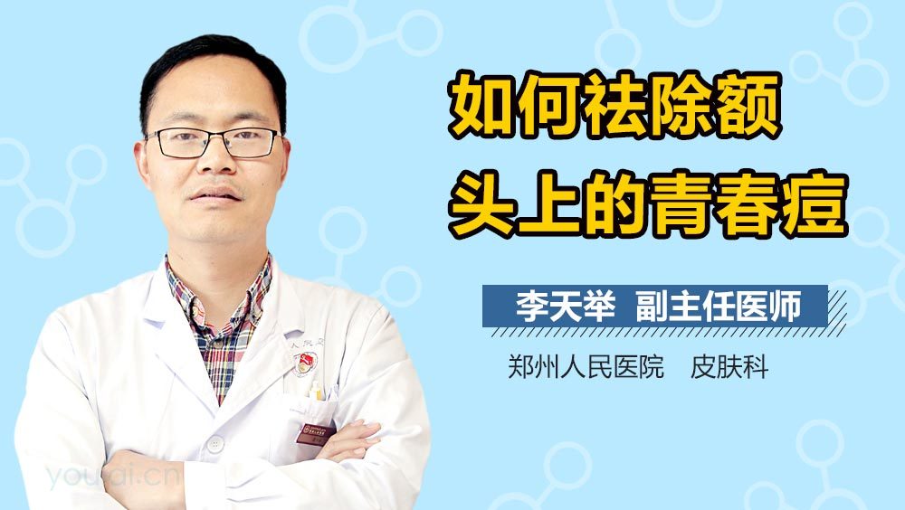 如何祛除额头上的青春痘