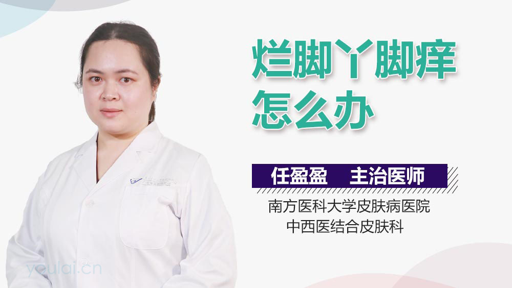 烂脚丫脚痒怎么办