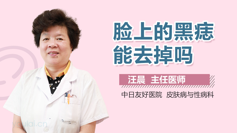 脸上的黑痣能去掉吗