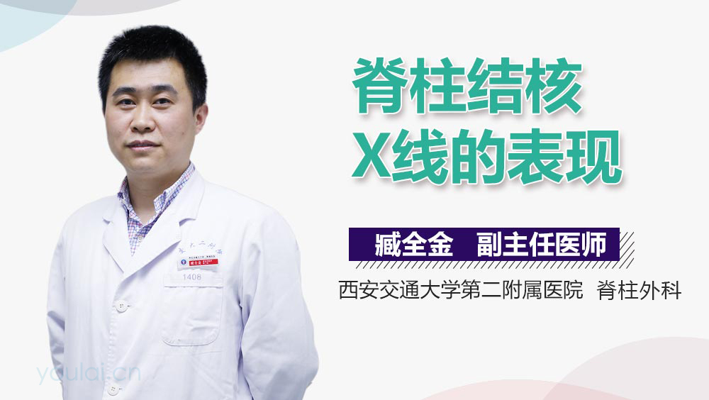 脊柱结核X线的表现