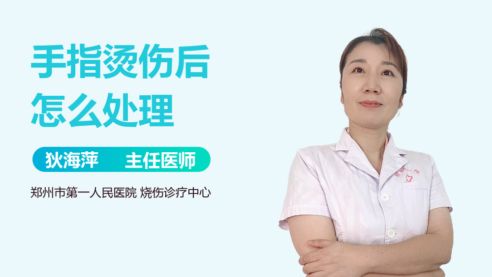 手指烫伤后怎么处理