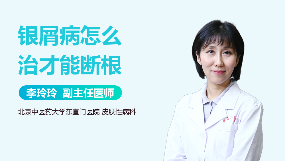 银屑病怎么治才能断根