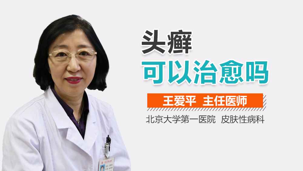 头癣可以治愈吗