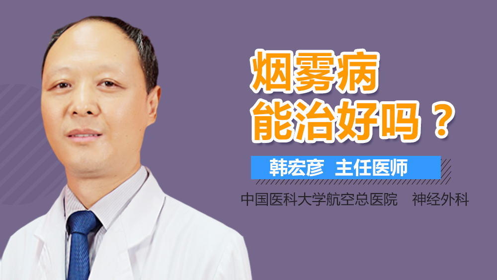 烟雾病能治好吗
