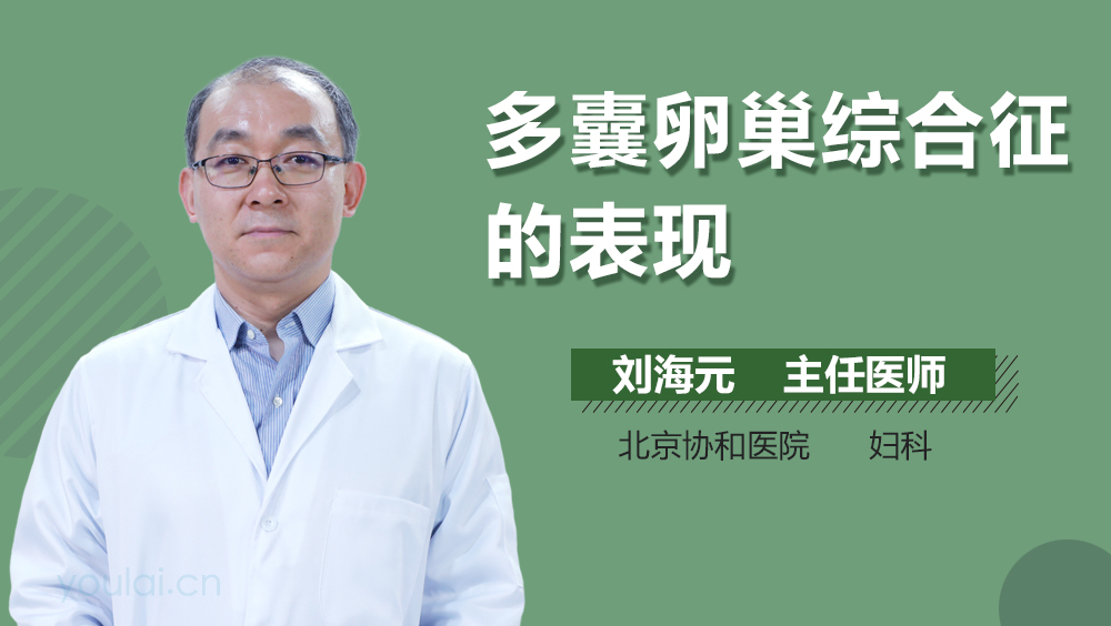 多囊卵巢综合征的表现