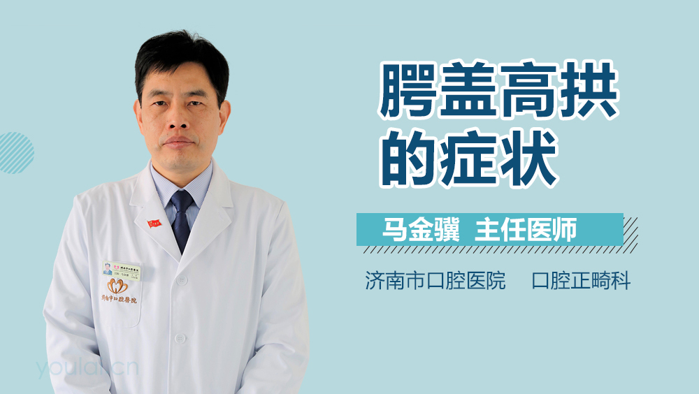 腭盖高拱的症状