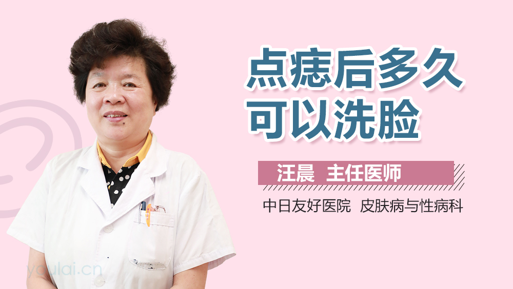 点痣后多久可以洗脸