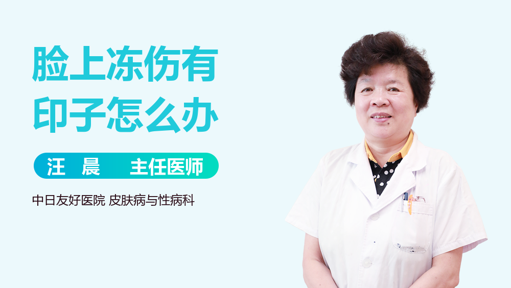 脸上冻伤有印子怎么办