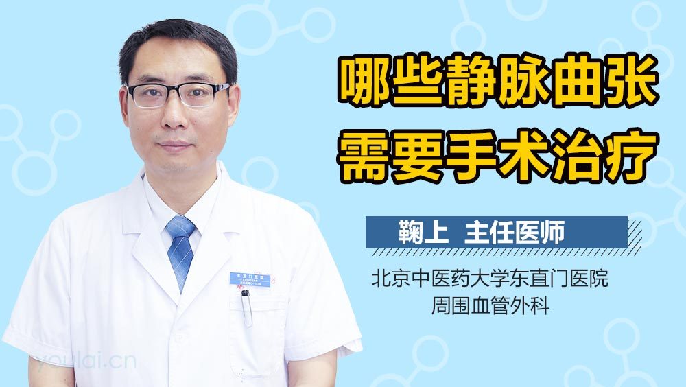 哪些静脉曲张需要手术治疗