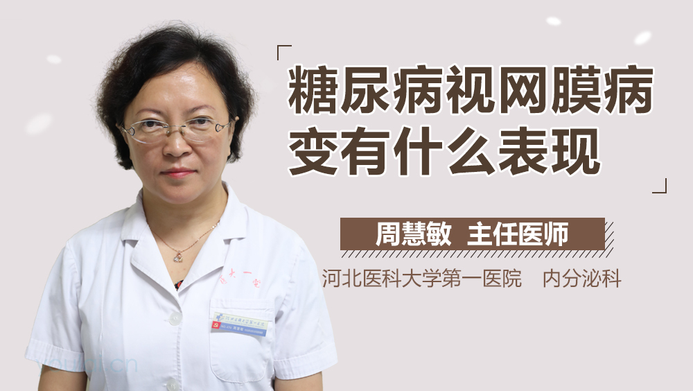 糖尿病视网膜病变有什么表现