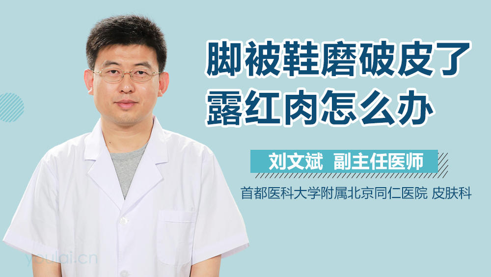 脚被鞋磨破皮了露红肉怎么办