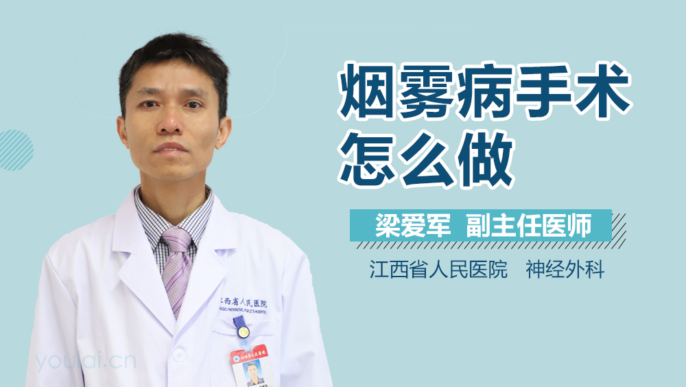 烟雾病手术怎么做