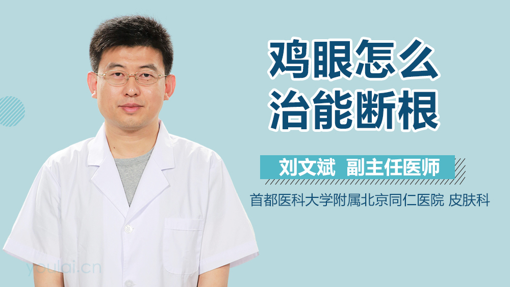 鸡眼怎么治能断根