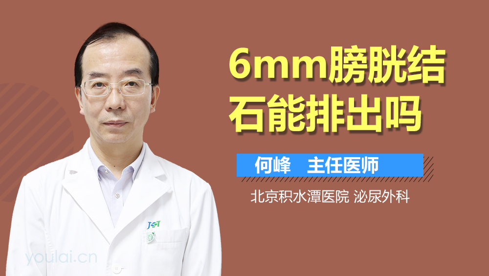 6mm膀胱结石能排出吗