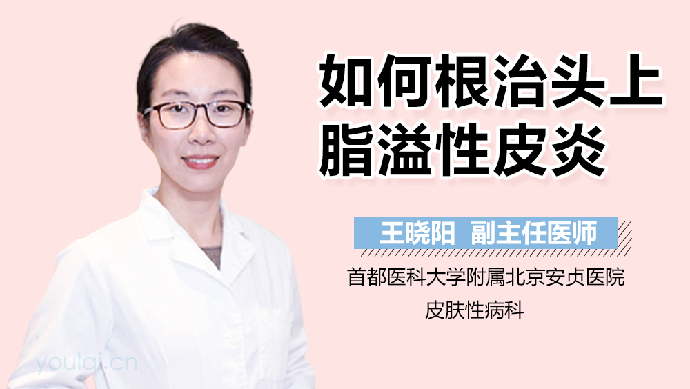 如何根治头上脂溢性皮炎