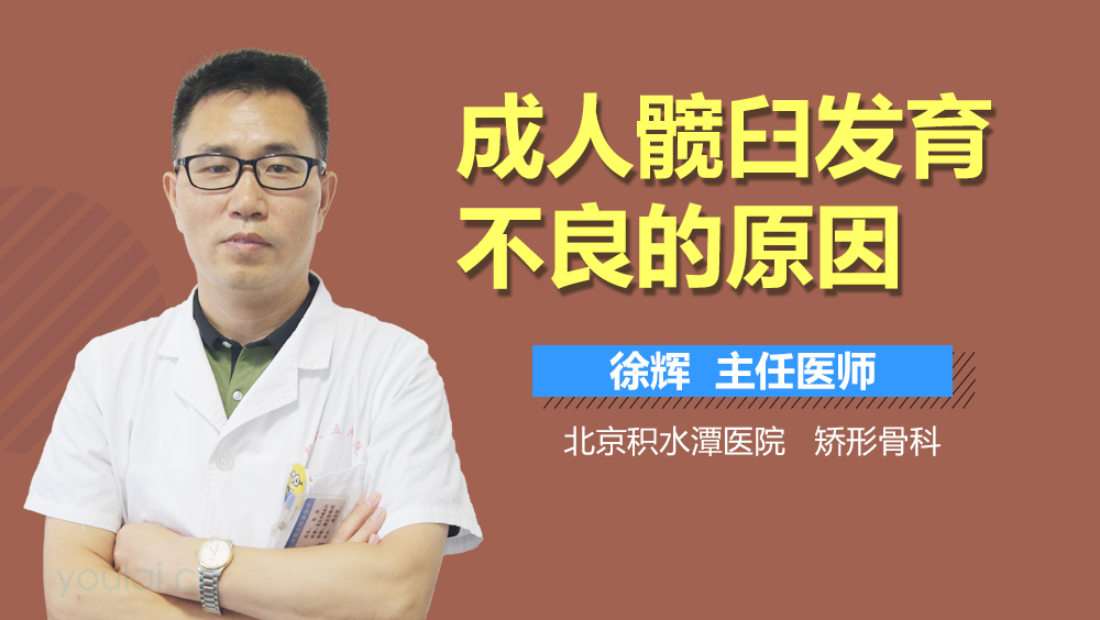 成人髋臼发育不良的原因