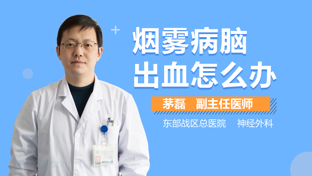 烟雾病脑出血怎么办
