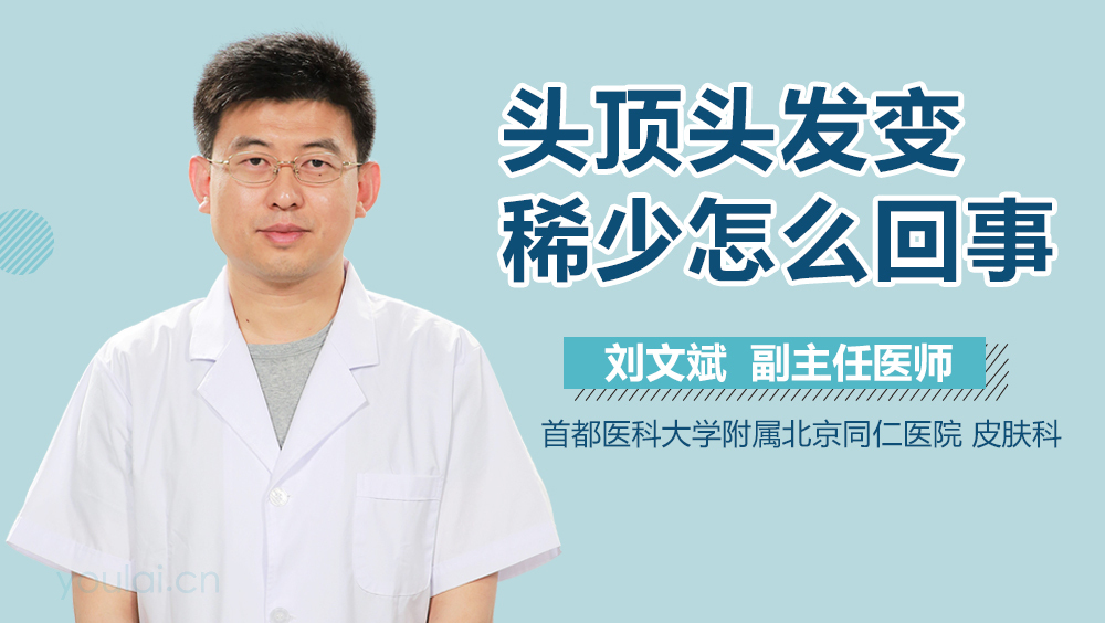 头顶头发变稀少怎么回事