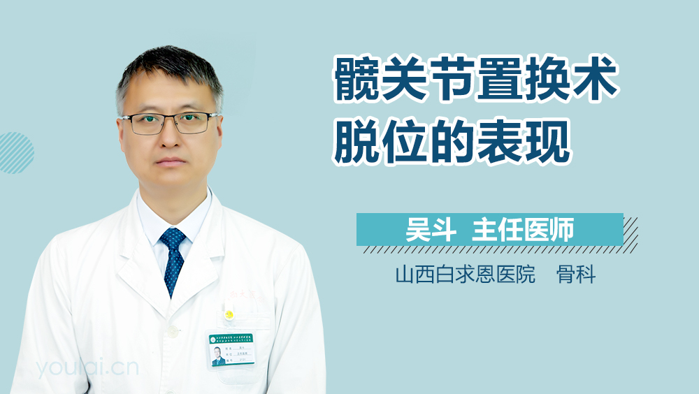 髋关节置换术脱位的表现