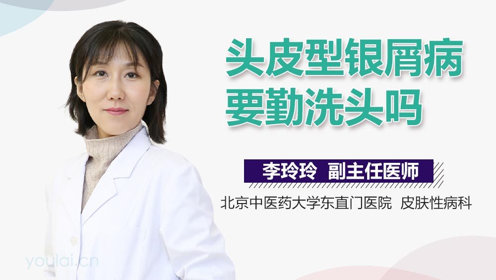 头皮型银屑病要勤洗头吗