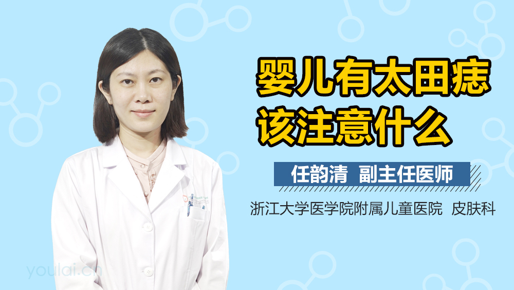 婴儿有太田痣该注意什么