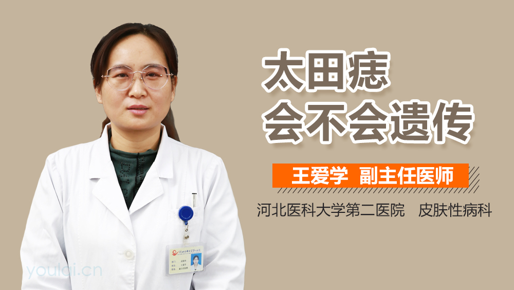 太田痣会不会遗传
