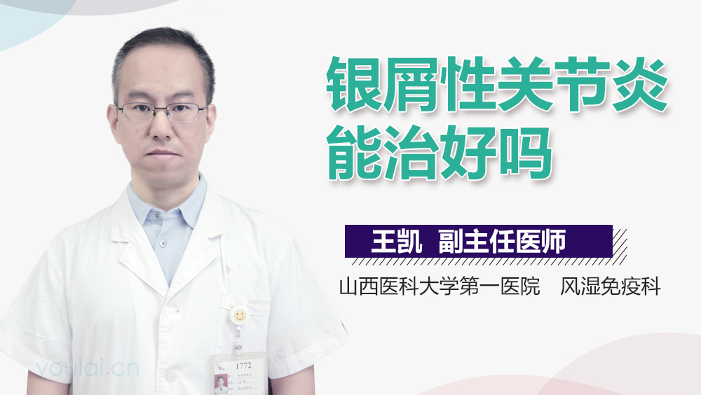 银屑性关节炎能治好吗
