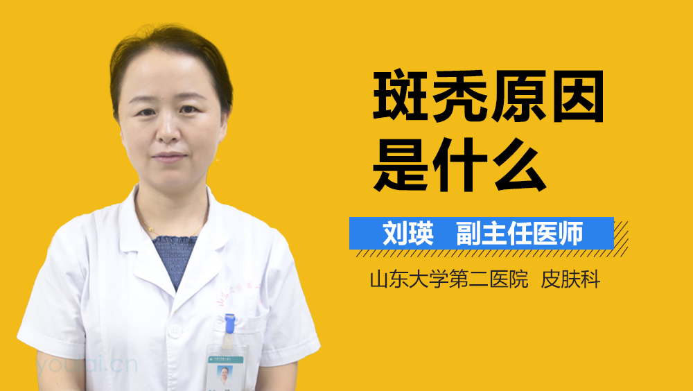 斑秃原因是什么