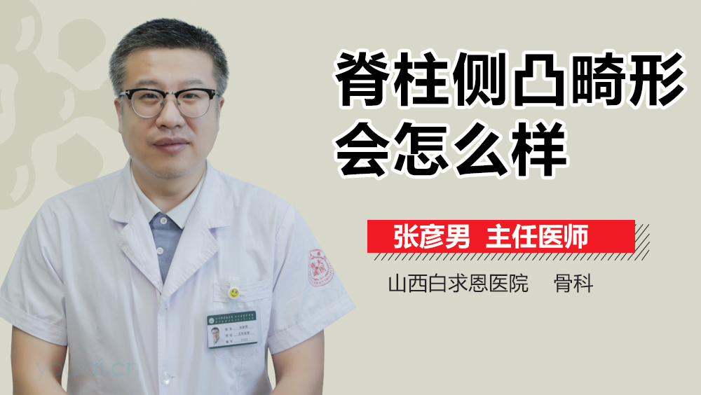 脊柱侧凸畸形会怎么样