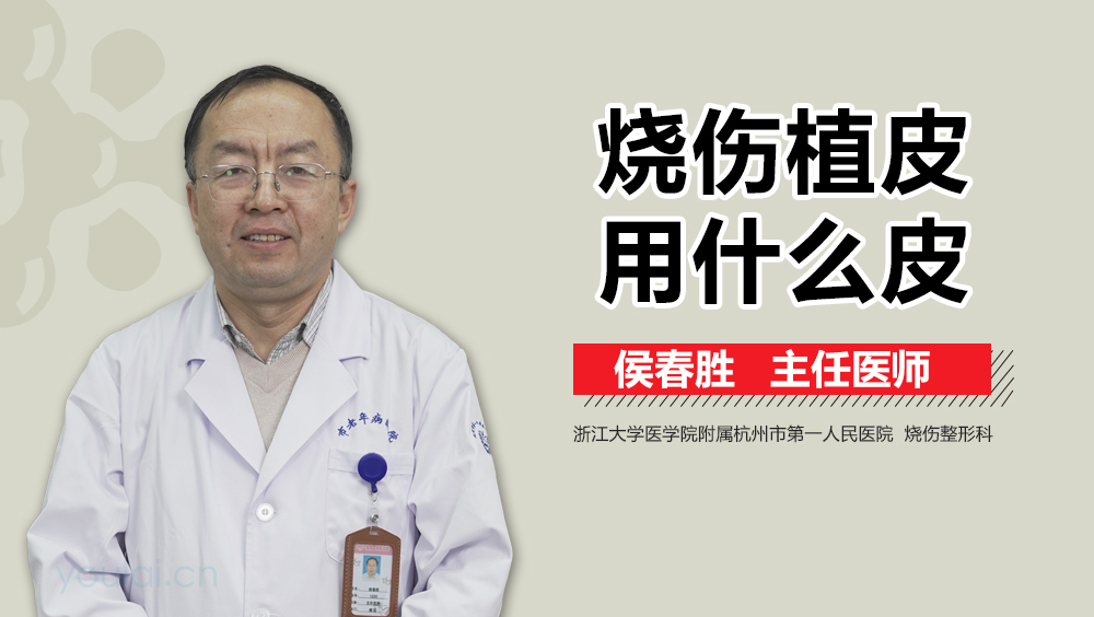 烧伤植皮用什么皮