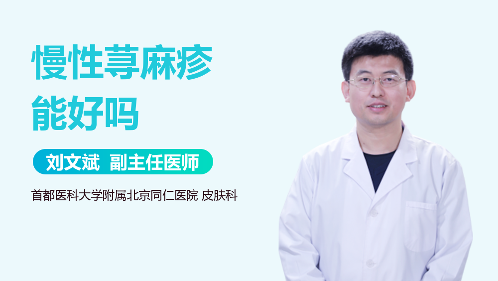 慢性荨麻疹能好吗