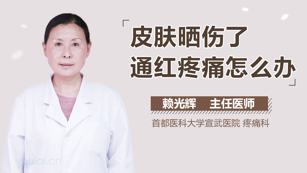 皮肤晒伤了通红疼痛怎么办