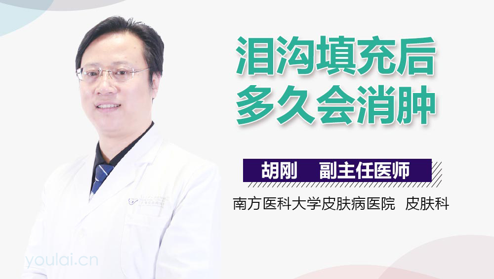 泪沟填充后多久会消肿