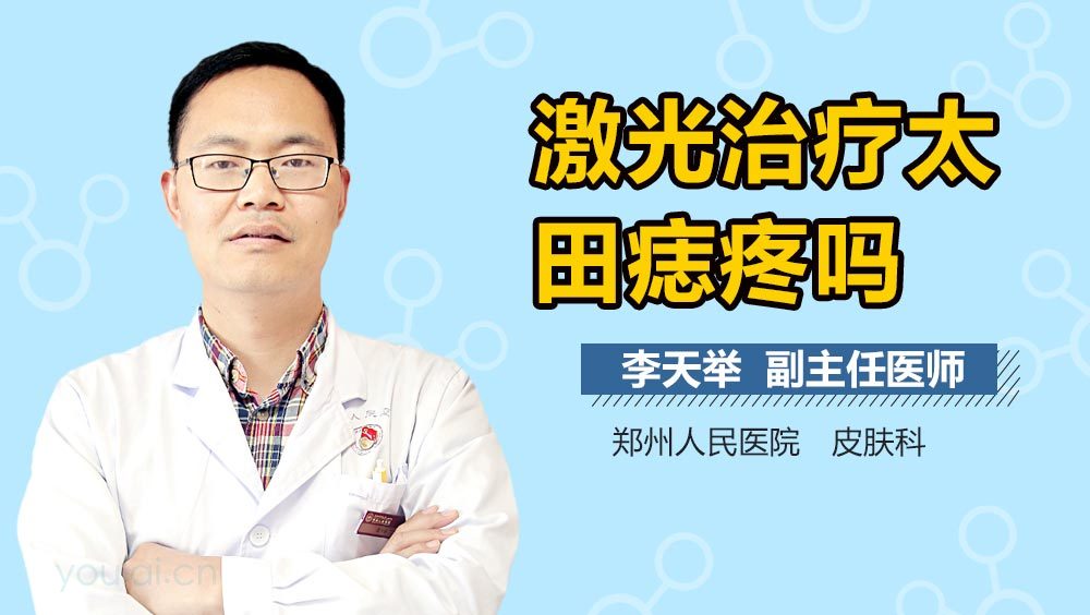 激光治疗太田痣疼吗