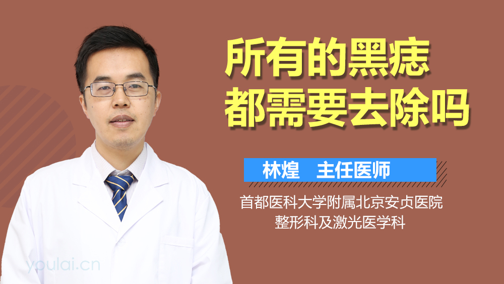 所有的黑痣都需要去除吗
