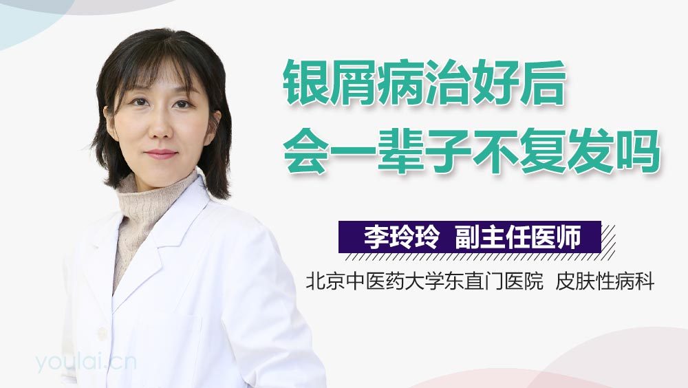 银屑病治好后会一辈子不复发吗