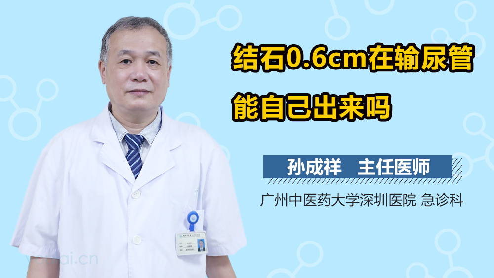 结石0.6cm在输尿管能自己出来吗