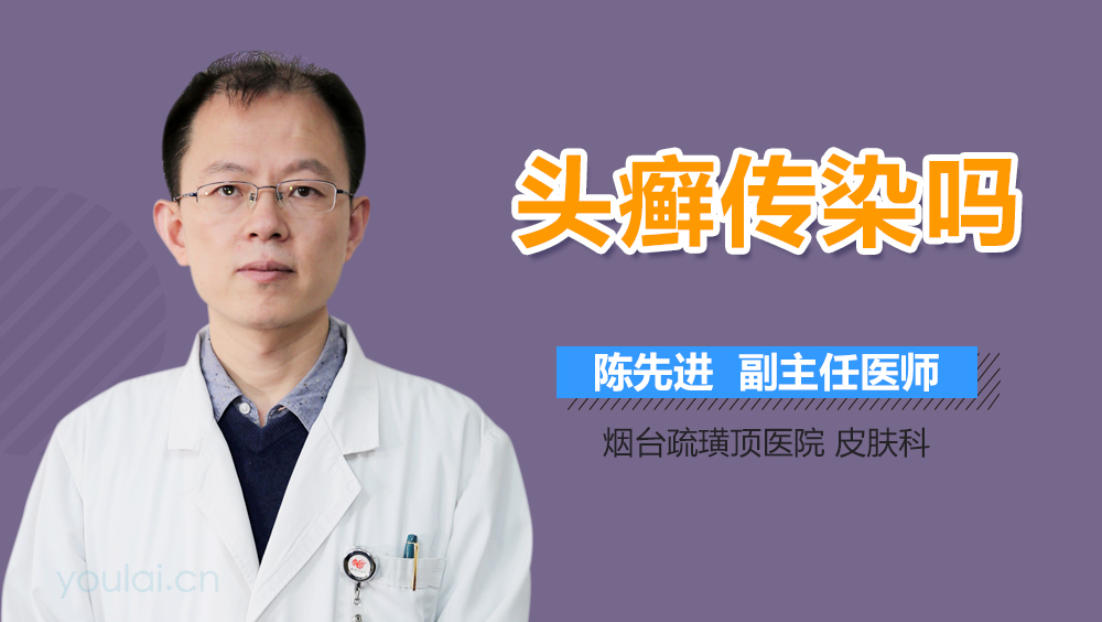 头癣传染吗
