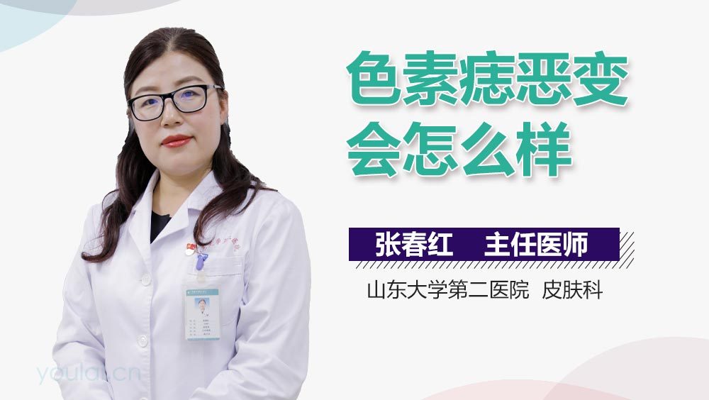 色素痣恶变会怎么样