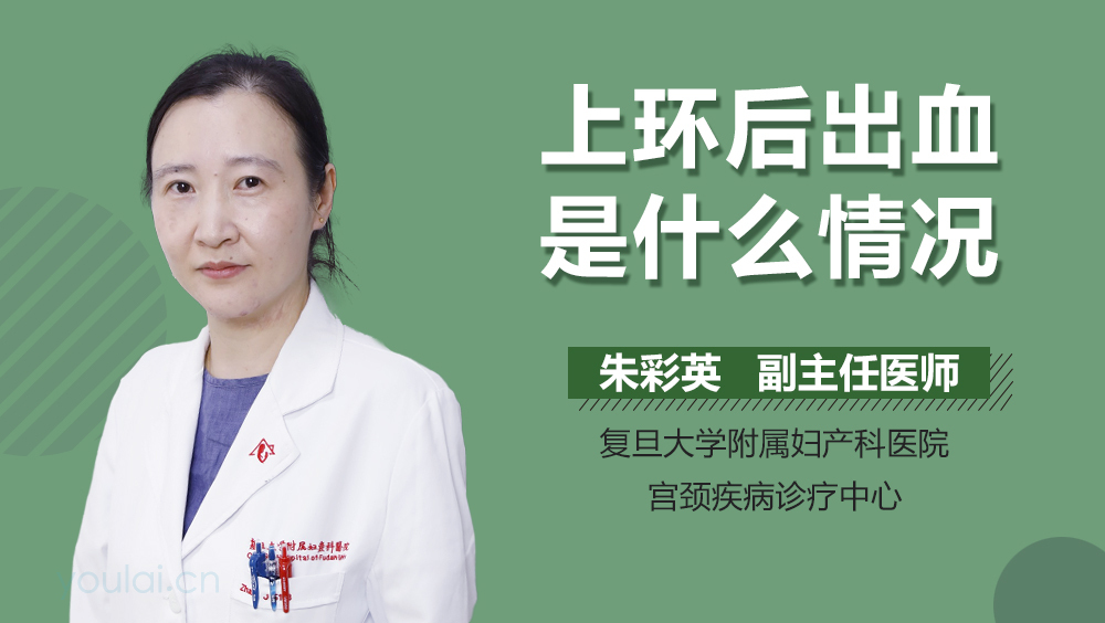 上环后出血是什么情况