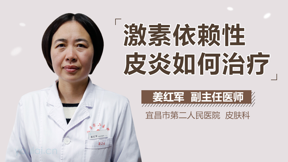 激素依赖性皮炎如何治疗