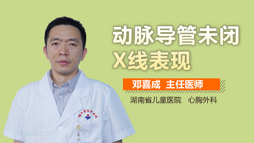 动脉导管未闭X线表现